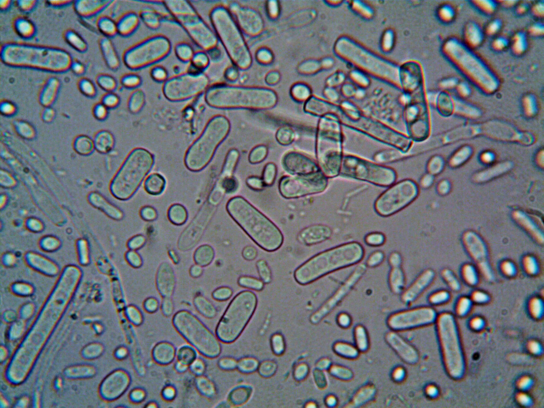 Close-up image of rod-shaped bacteria under a microscope, showcasing microscopic detail.